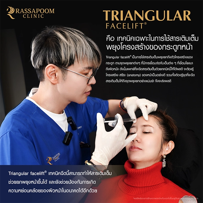 Filler injection (Triangular Face Lift)